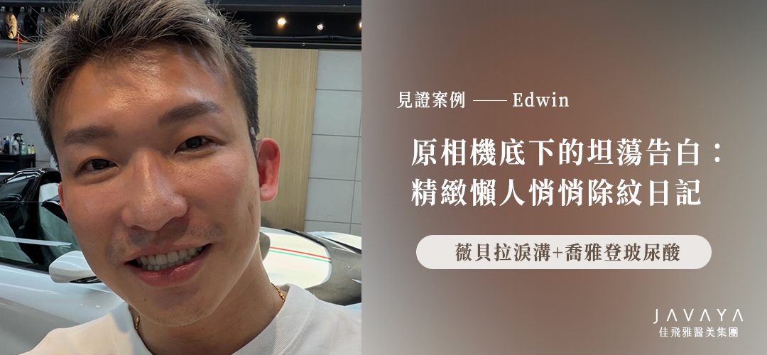 原相機底下的坦蕩告白:精緻懶人悄悄除紋日記-Edwin